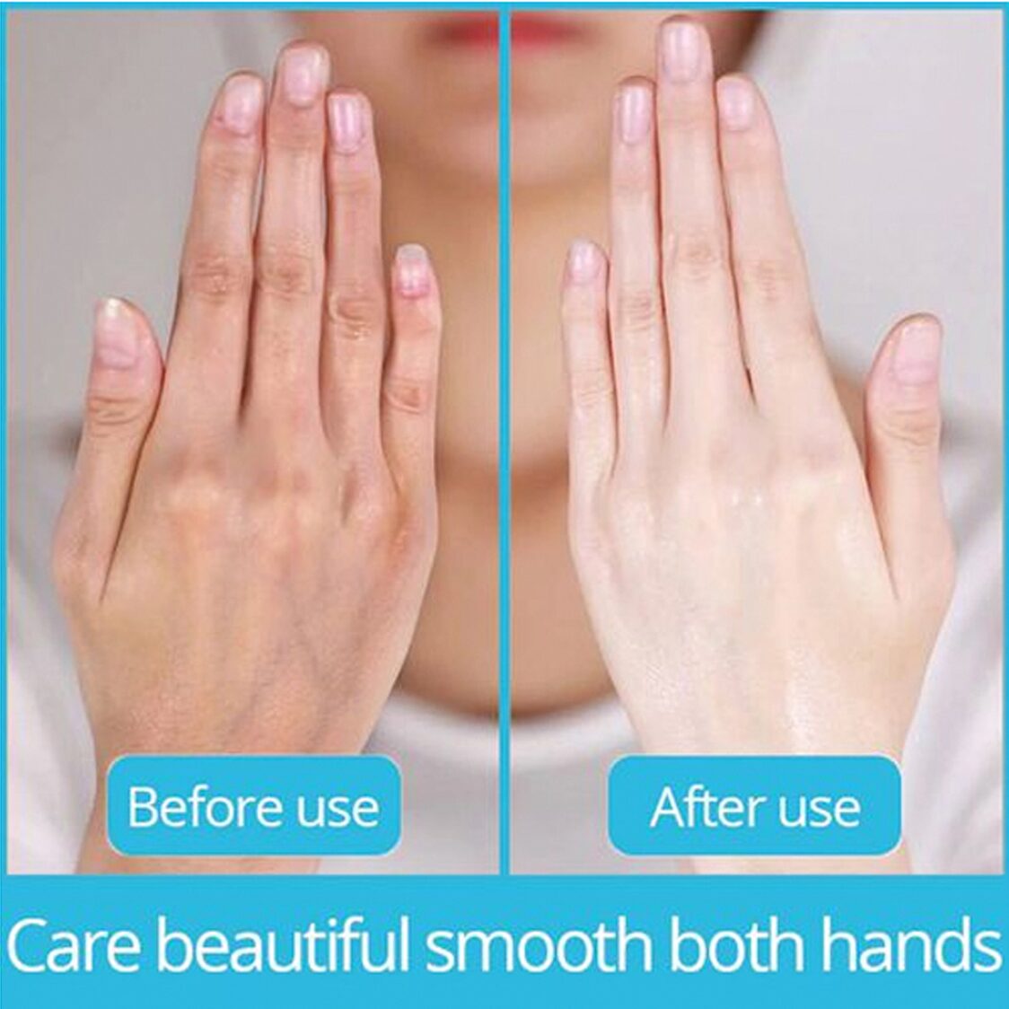 (1 แผ่น) Mediheal Theraffin Hand Mask 7mL เมดิฮีล แผ่นมาสก์ถุงมือ ช่วยบำรุงผิวและเล็บมือ ให้เนียนนุ่ม สุขภาพดี