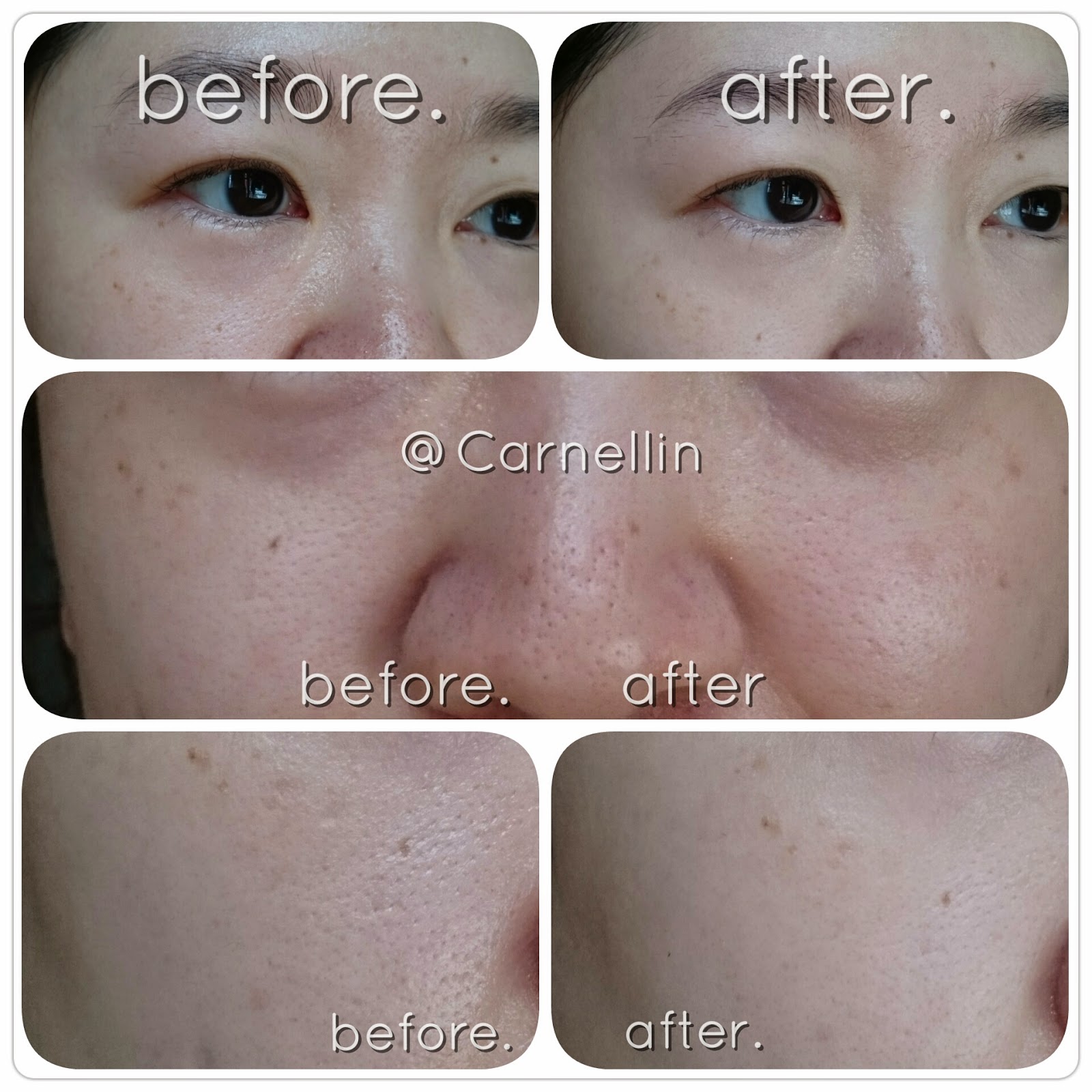 (ลดมากกว่า 21%) Bioderma Sebium Pore Refiner 30mL ครีมเจลช่วยกระชับรูขุมขน ปรับผิวให้เนียนเรียบ พร้อมผลัดผิวใหม่ให้ขาวกระจ่างใส