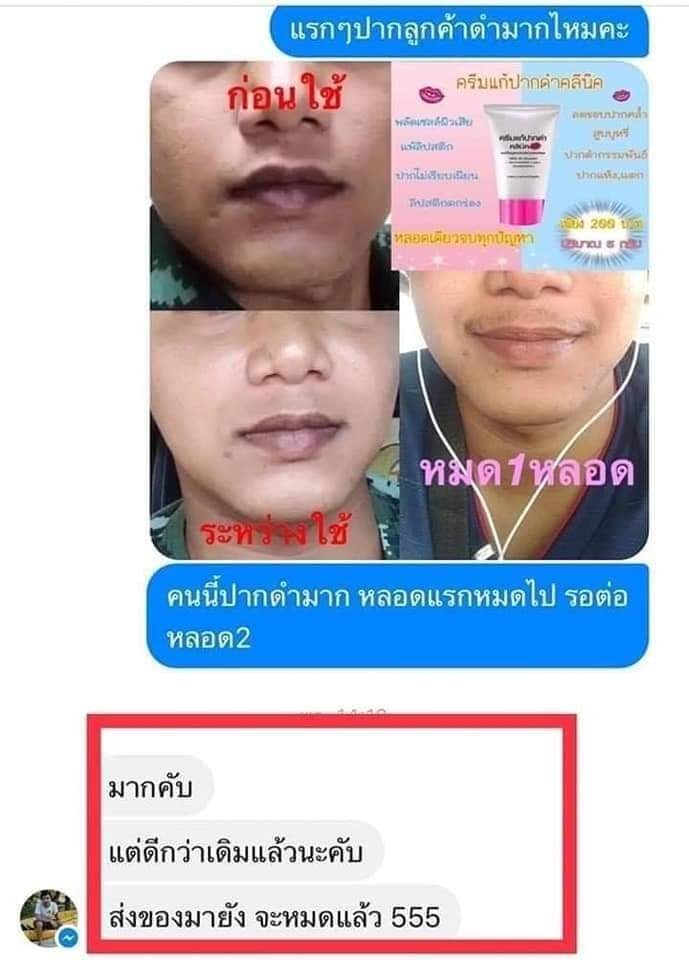 ครีมแก้ปากดำ คลินิค ลิปแก้ปากดำ