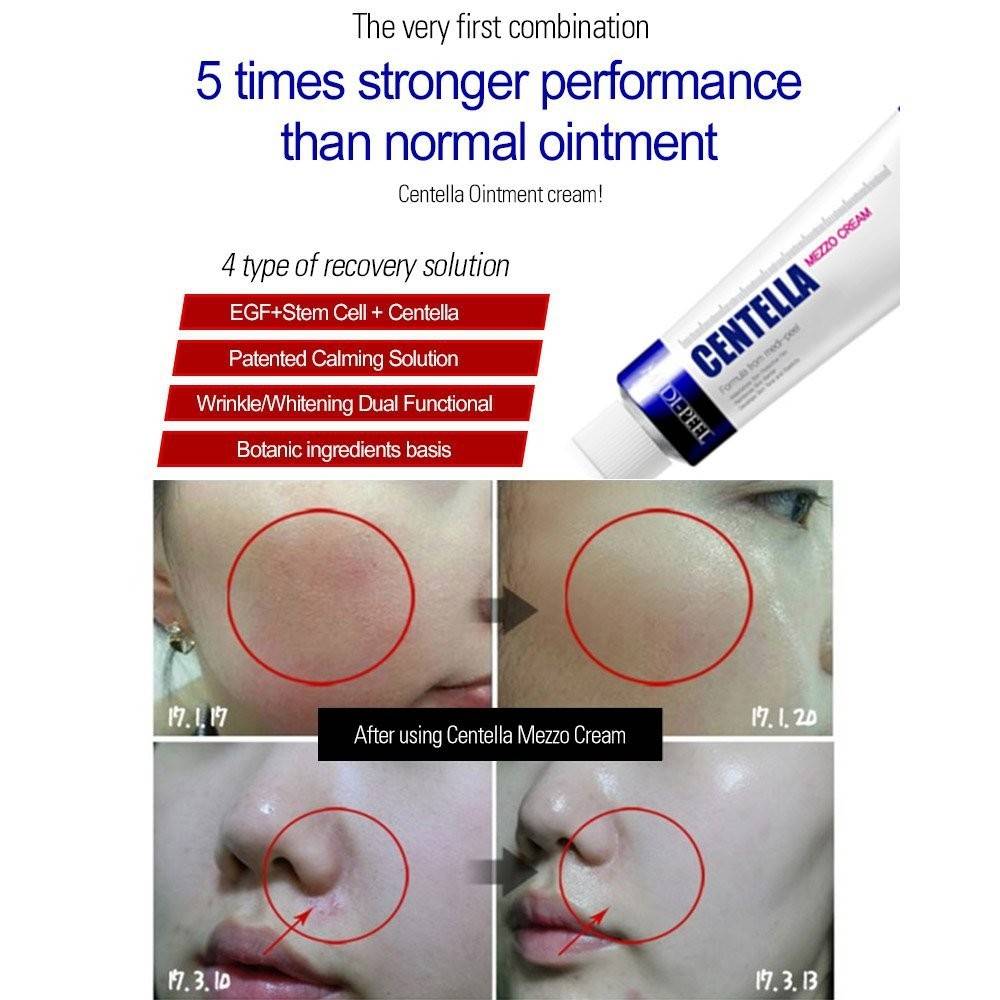 (พร้อมส่ง) Medi-Peel Centella Mezzo Cream 30mL เมดิพีล เซนเทลล่า เหมาะสำหรับผู้ที่มีปัญหาผิวเป็นสิว มีรอยแดงสิว และผิวแพ้ง่าย เพราะส่วนผสมอ่อนโยน