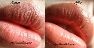 Kiehl's Lip Balm #1 (15 mL) ไม่มีกลิ่น ลิปบาล์มสูตรคลาสสิค ปกป้องและช่วยบรรเทาอาการริมฝีปากแห้งแตกชั่วคราว ช่วยปกป้องริมฝีปากจากลมและอากาศหนาวบาล์มเนื้อนุ่ม ลื่น ทาง่ายเป็นพิเศษ