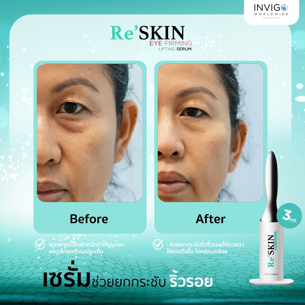 รีวิว ReSKIN Invigo รีสกิน เซรั่ม ยกกระชับ ลดริ้วรอย ถุงใต้ตา จาก อินวีโก้