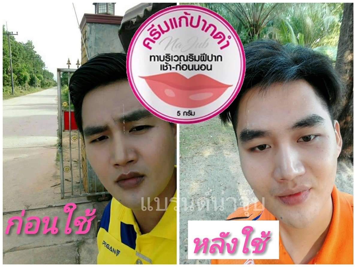 ครีมแก้ปากดำ คลินิค ลิปแก้ปากดำ
