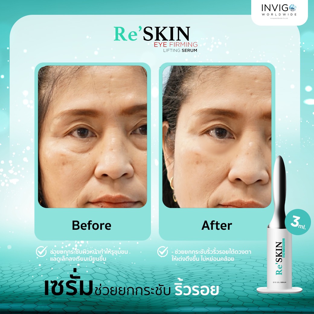 รีวิว ReSKIN Invigo รีสกิน เซรั่ม ยกกระชับ ลดริ้วรอย ถุงใต้ตา จาก อินวีโก้