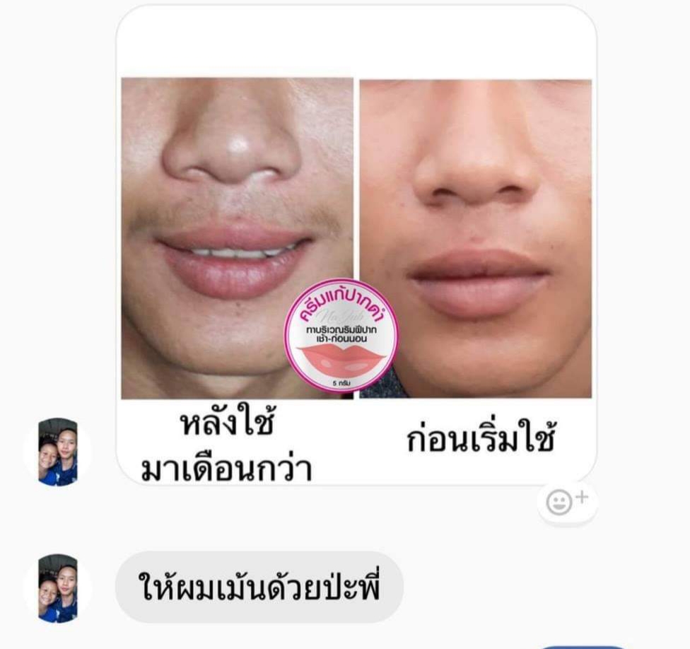 ครีมแก้ปากดำ คลินิค ลิปแก้ปากดำ