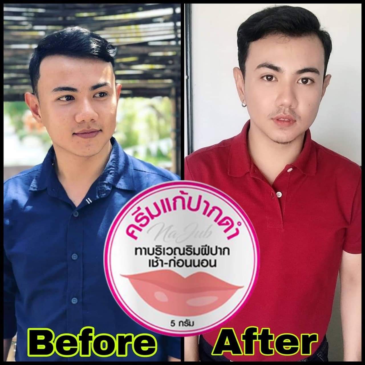 ครีมแก้ปากดำ คลินิค ลิปแก้ปากดำ