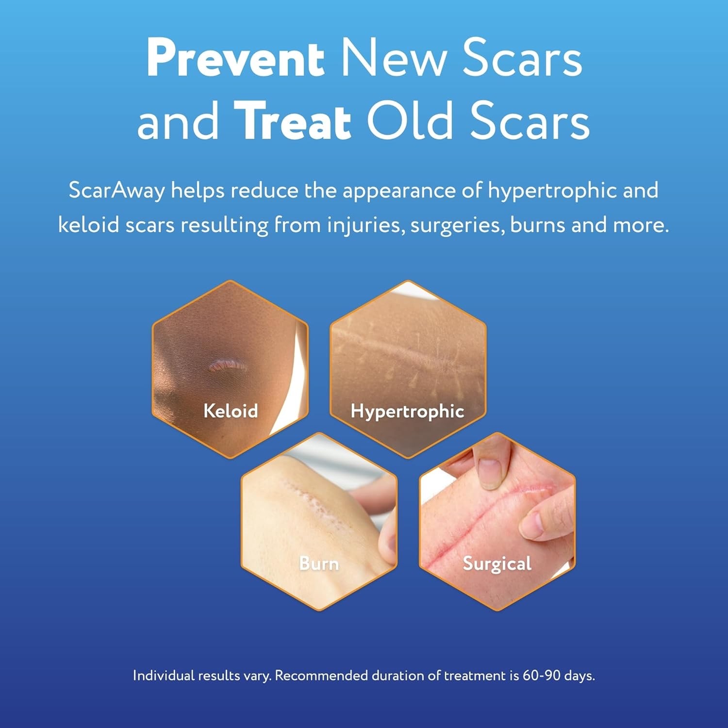 เจลซิลิโคนลดรอยแผลเป็นสำหรับเด็ก ScarAway Silicone Scar Gel for Kids (6g)