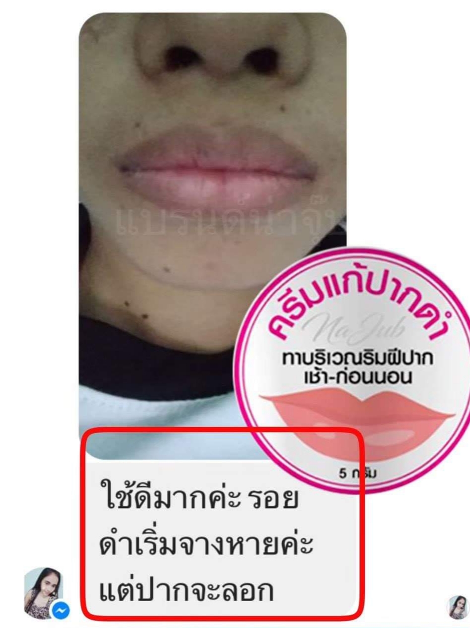 ครีมแก้ปากดำ คลินิค ลิปแก้ปากดำ