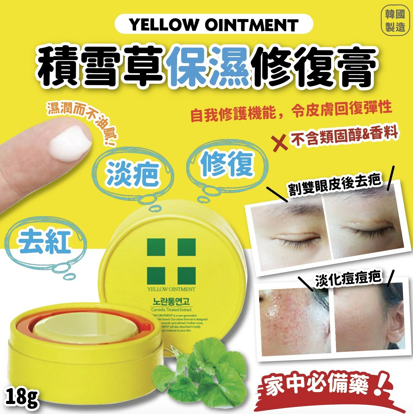Yellow Ointment Centella Treated Extract 18g ครีมดูแลแผลเป็นและรอยสิว ที่ รพ.เกาหลีนิยมมากๆ พร้อมช่วยเรื่องรูขุมขนกระชับ ผิวละเอียด เรียบเนียน