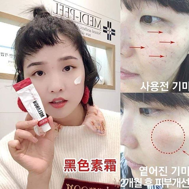 Medi-Peel Melanon X 30mL ครีมฝ้ากระ ที่ฮอตมากๆ ในเกาหลี นิยมใช้ในคลีนิคและสปาผิวของเกาหลีค่ะ