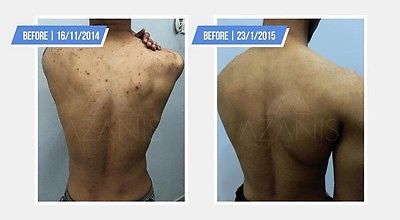 AZANIS SCAR SERUM แท้100%