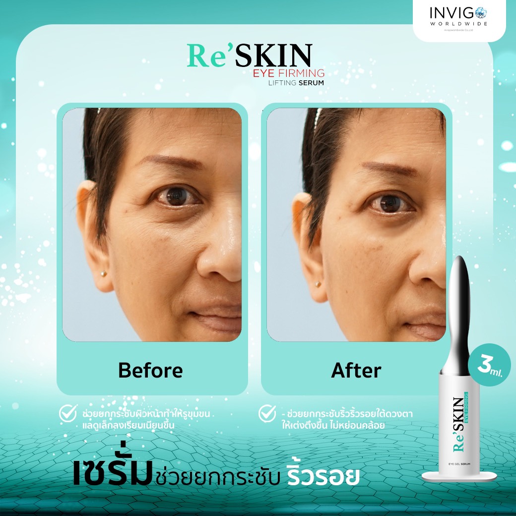 รีวิว ReSKIN Invigo รีสกิน เซรั่ม ยกกระชับ ลดริ้วรอย ถุงใต้ตา จาก อินวีโก้