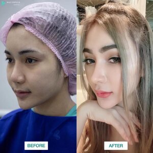 คลีนิกทำตาสองชั้น โทร 095-5266242 เสริมหน้าอก เสริมจมูก ทำตา2ชั้น สำหรับผู้หญิงเรา ต้องสวย เพราะความสวยจะเปลี่ยนชีวิต