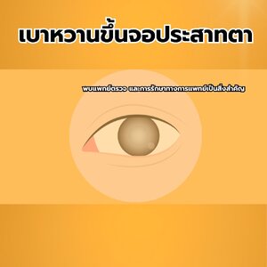 ภาวะเบาหวานขึ้นจอประสาทตา