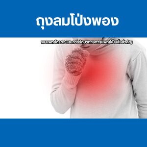 ถุงลมโป่งพอง