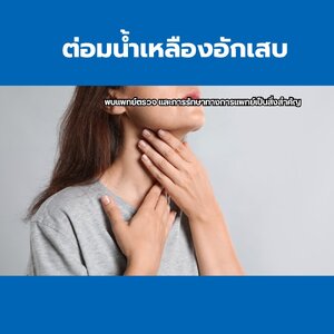 ต่อมน้ำเหลืองอักเสบ