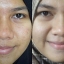 AZANIS SCAR SERUM แท้100%