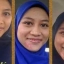 AZANIS SCAR SERUM แท้100%